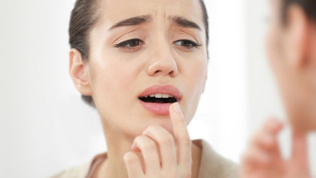 5 مكونات لعلاج قرحة الفم بسرعة